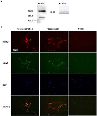 KCNQ1 Potassium Channel Expressed in Human Sperm Is Involved in Sperm Motility, Acrosome Reaction, Protein Tyrosine Phosphorylation, and Ion Homeostasis During Capacitation